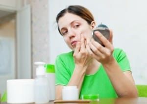 Acne behandelen